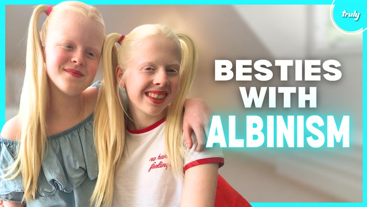 Video thumbnail for The Besties With Albinism: 7 Years Later | BORN DIFFEREN