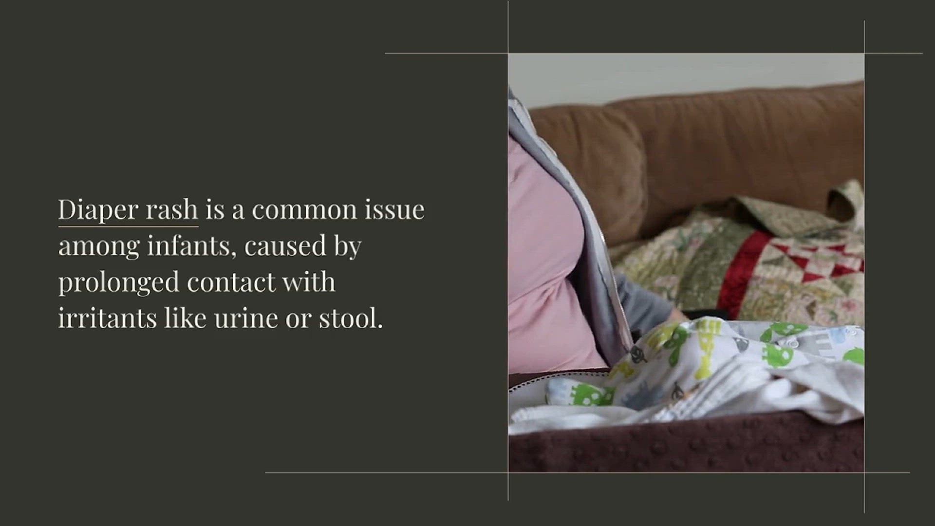 Video thumbnail for Best Diaper For Sensitive Skin