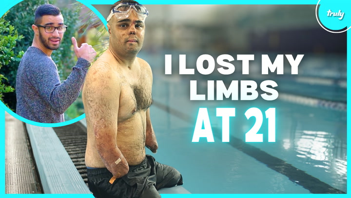 Video thumbnail for I Lost My Limbs & Nose - But Not My Love For Life | BORN DIFFERENT