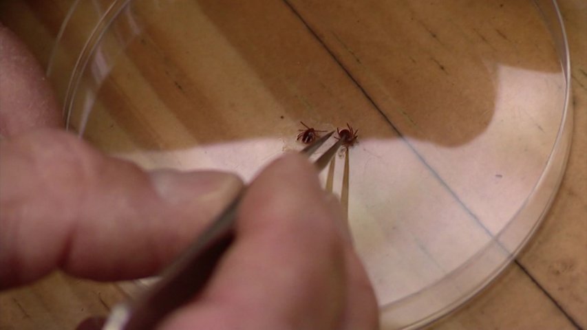 Video thumbnail for Ridge man diagnosed with rare tick-borne illness 'Rabbit Fever'