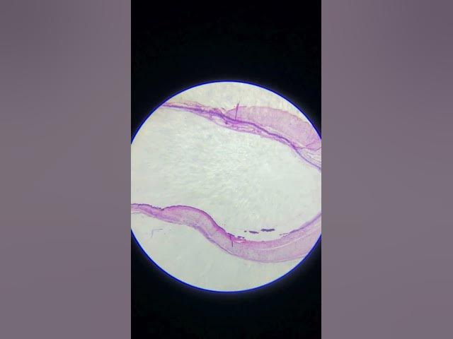 Video thumbnail for hyaline cartilage under microscope #microbiology #infectiousdiseases #cellbiology #marinebiology