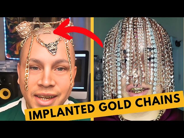 Video thumbnail for Rapper Has Gold Chains Implanted Into His Head