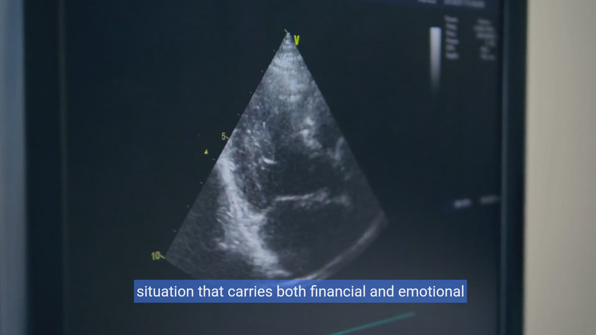 'Video thumbnail for Navigating Ultrasound Costs Without Insurance: A Guide'