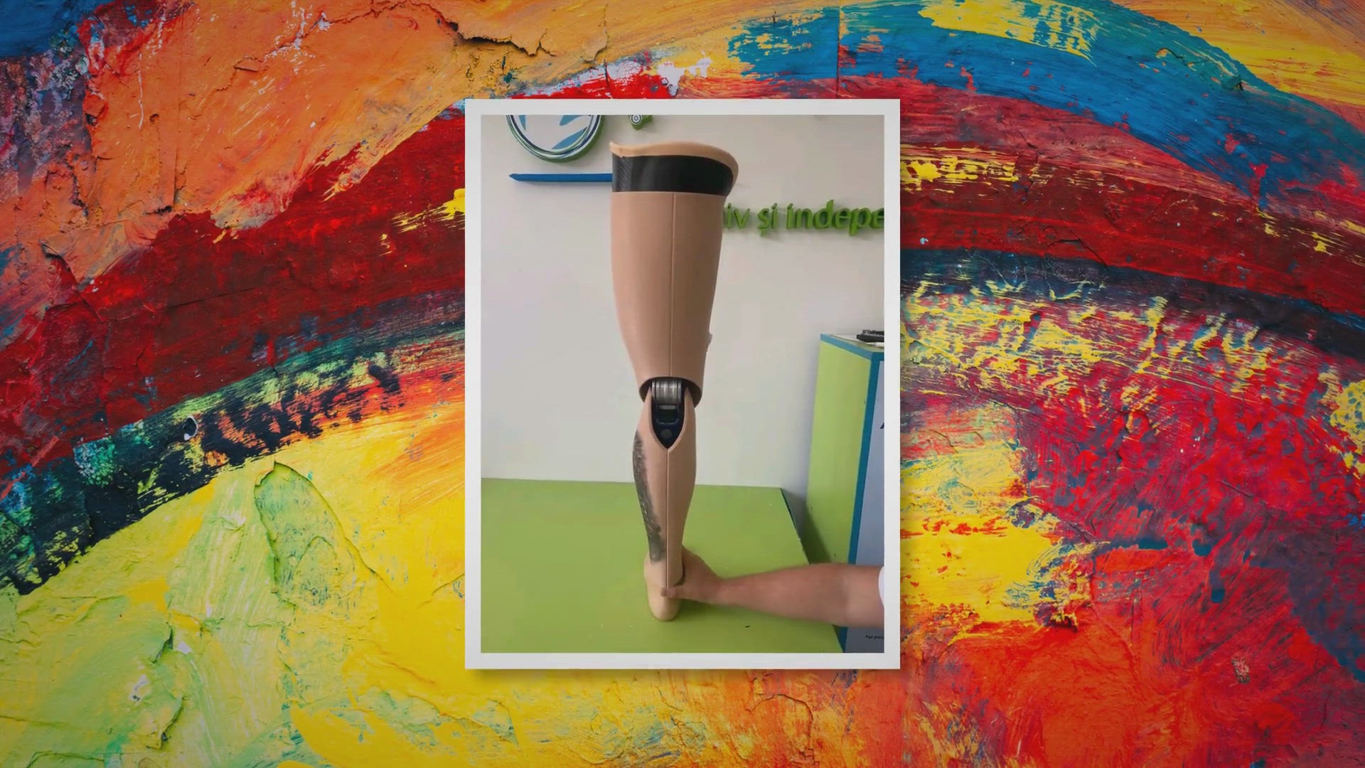 Video thumbnail for Prosthetic Centres in Kenya