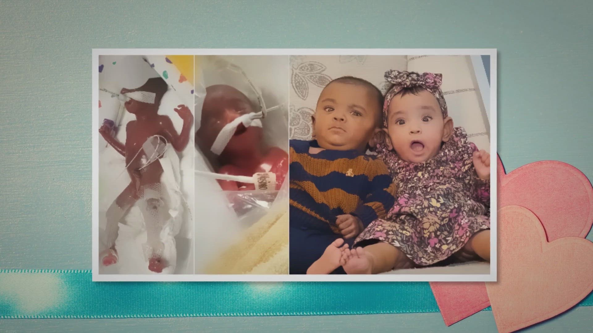 'Video thumbnail for ‘0% chance of survival’: World’s most premature twins defy doctors'