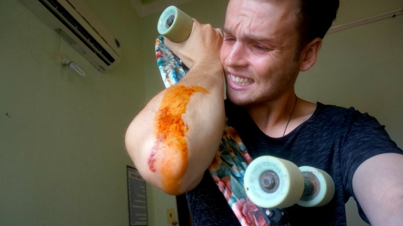 Video thumbnail for BAD SKATEBOARD FALL - VIETNAM TRAVEL