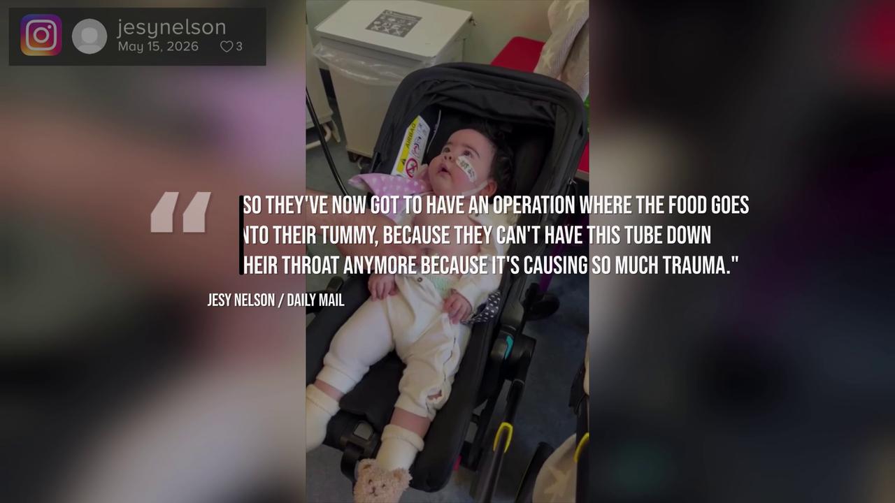 Video thumbnail for Jesy Nelson reveals daughter needs scoliosis surgery.