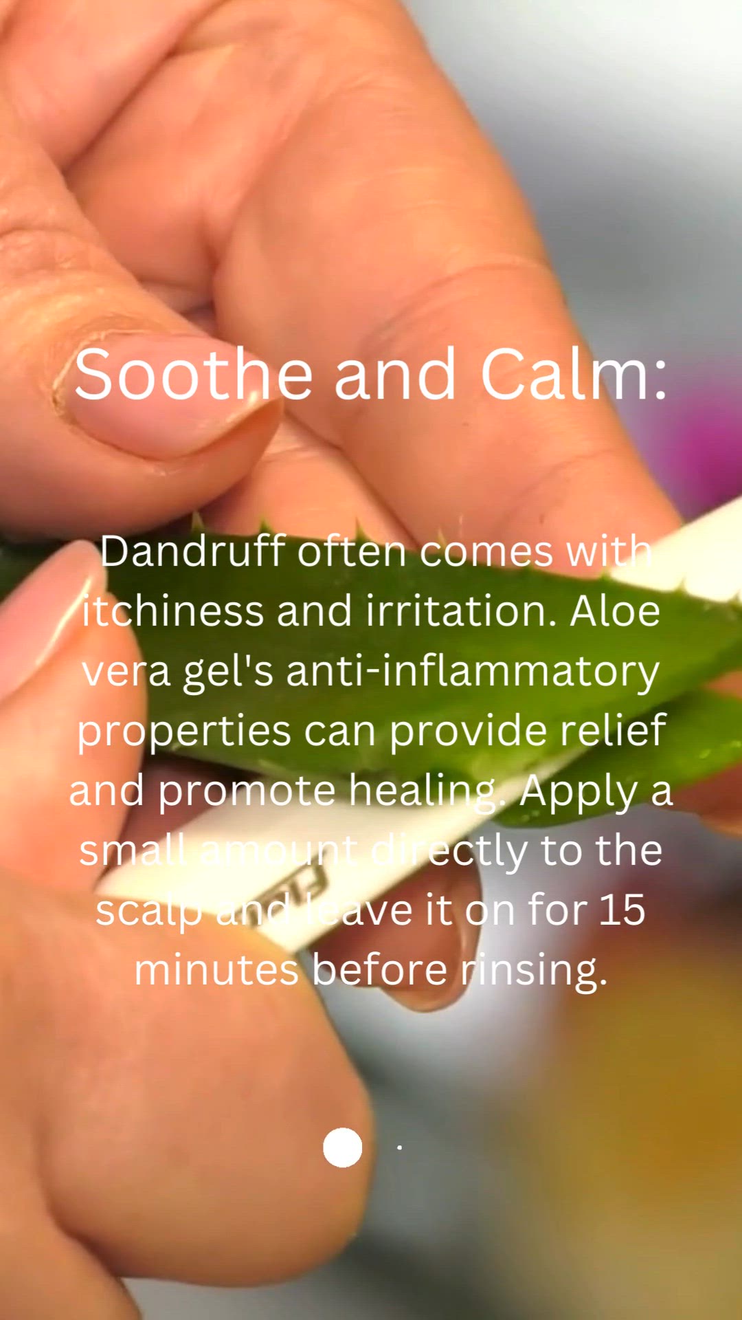 Video thumbnail for Dealing with Dandruff