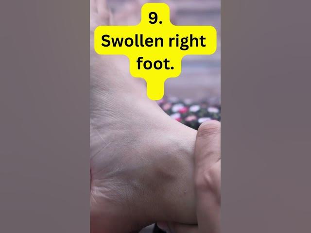 Video thumbnail for 13 Unnoticed Signs Of Liver Failure #shorts