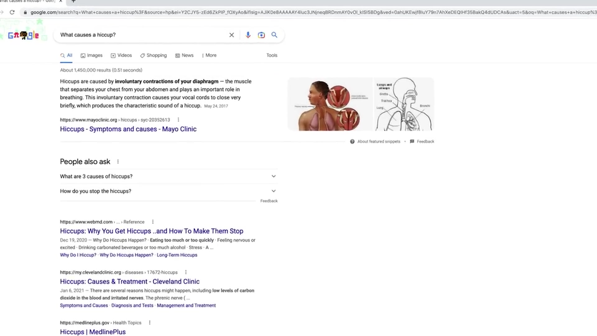 Video thumbnail for DON T Google your Symptoms(720P HD)