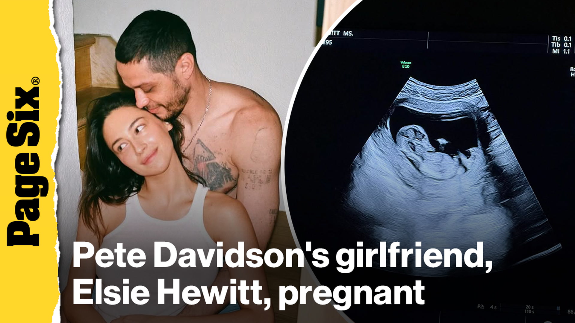 'Video thumbnail for Pete Davidson's girlfriend, Elsie Hewitt, announced that she's pregnant with couple's first baby'