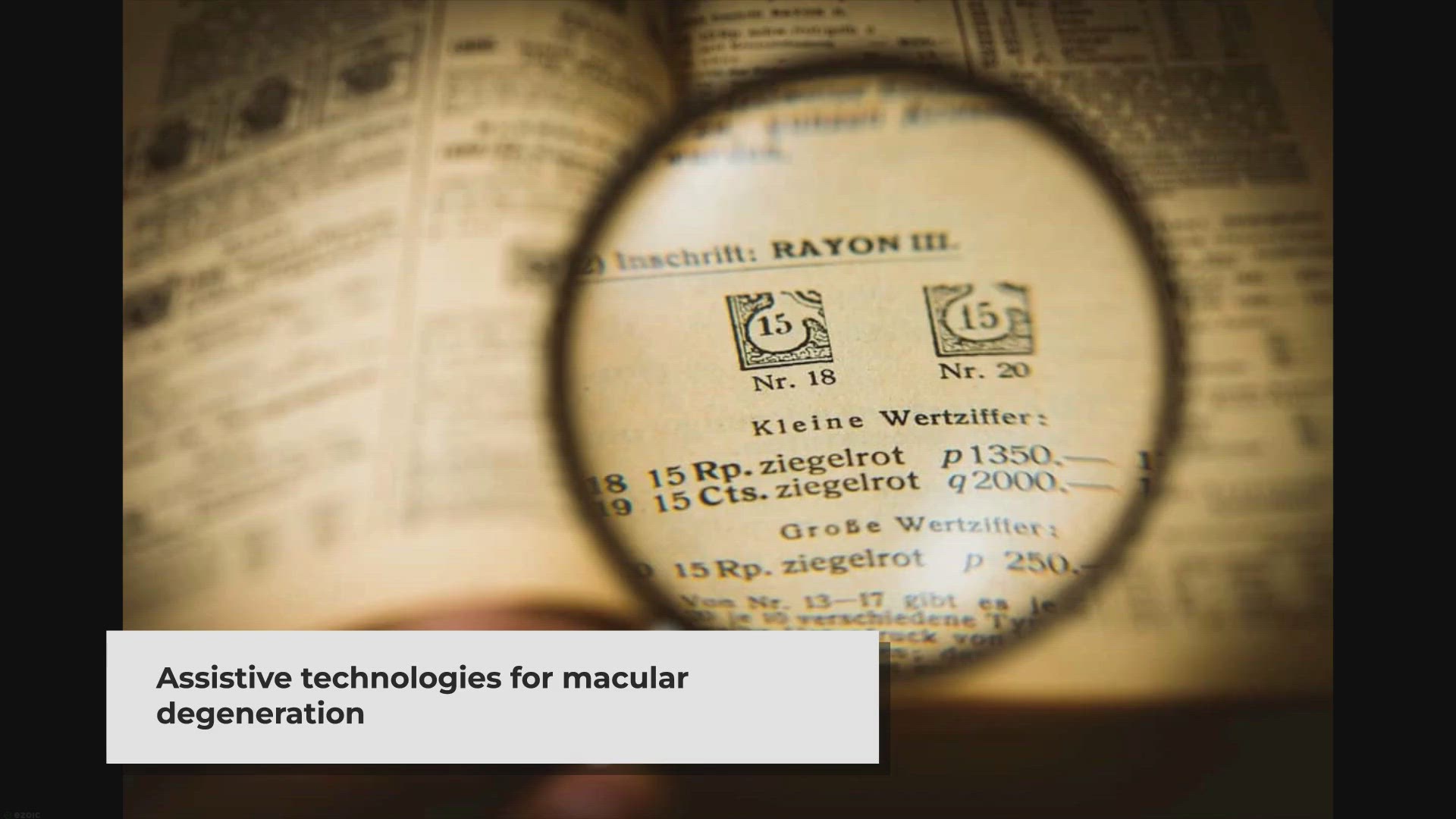 Video thumbnail for How do Those with Macular Degeneration See?