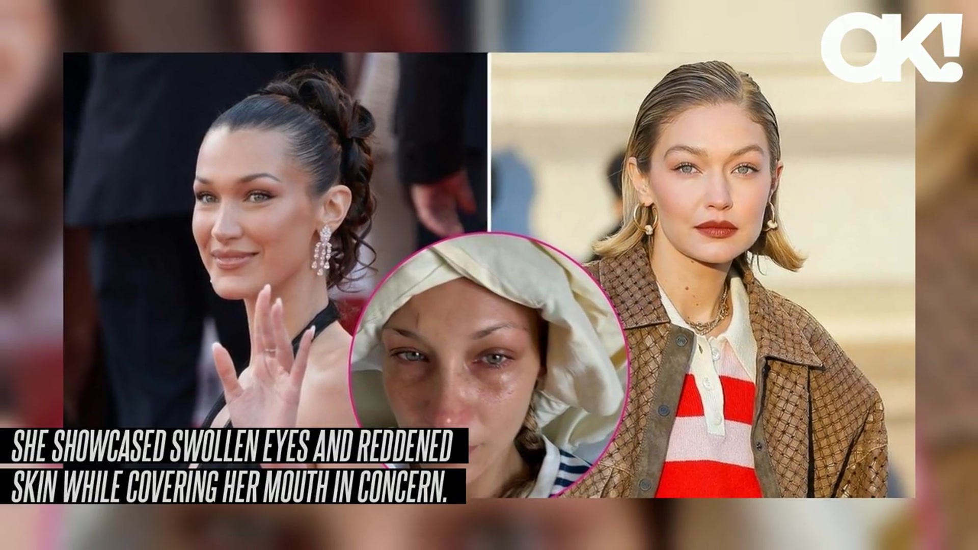 'Video thumbnail for Bella Hadid's Hospital Selfie Sparks Concern as Sister Gigi Hadid Sends Message of Support'