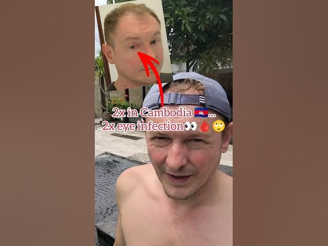 Video thumbnail for Don’t Use Tap Water in Cambodia ❌💧 My Pink Eye Story & Important Travel Tip 🚨