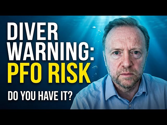 Video thumbnail for PFO & Diving: The Truth About the Hole in Your Heart with Dr Mark Turner
