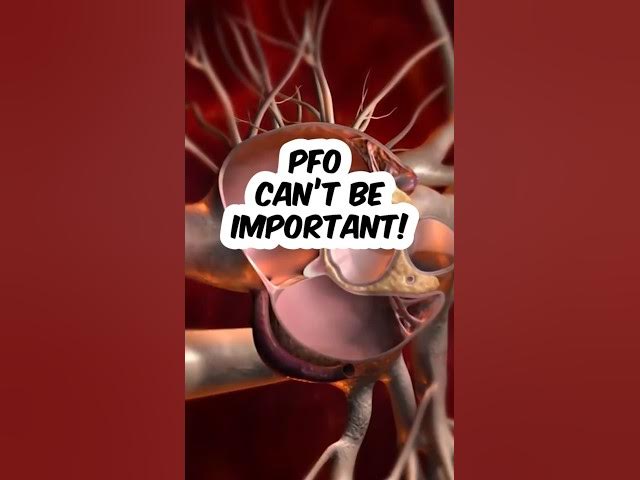 Video thumbnail for Does Diver Training Mislead us About PFOs?