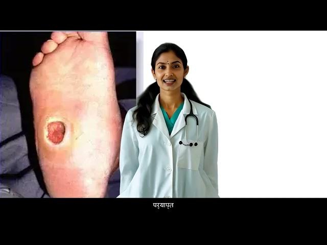 Video thumbnail for madhumeh pairon ko kaise prabhaavit karata hai