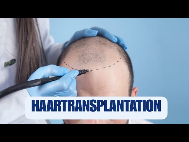 'Video thumbnail for Haartransplantation in der Türkei'