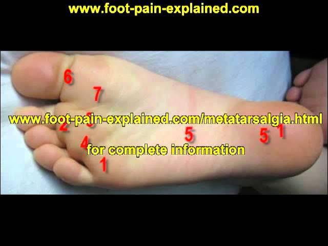 foot pain bottom of foot | Open Video