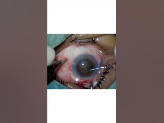 Video thumbnail for 14 September 2024