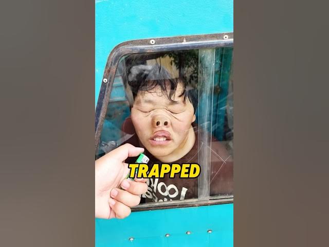 Video thumbnail for He Lit a Fuse in Her Nose#lol#laugh#rofl #toofunny