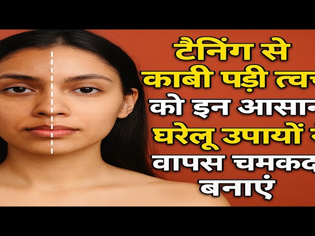 Video thumbnail for टैनिंग से काली दिखने लगी है स्किन? इन घरेलू उपायों से चमकाएं चेहरा  | #gharelunuskhe  | #mecup |