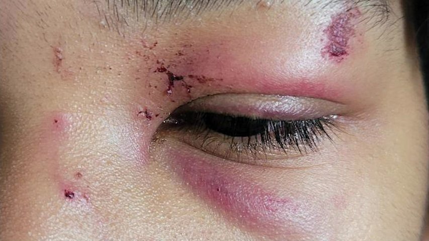 Video thumbnail for ‘To see him bloody, his glasses broken,’ Bronx mom wants answers after her son was randomly attacked