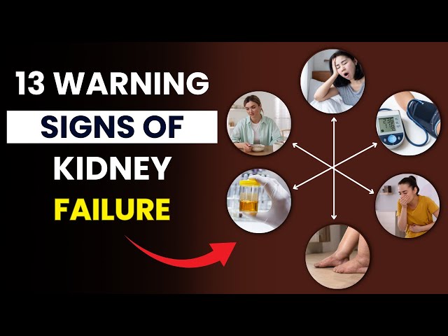 Video thumbnail for 13 Early Warning Signs of Kidney Failure You Should NEVER Ignore | Early Symptoms of Kidney Failure