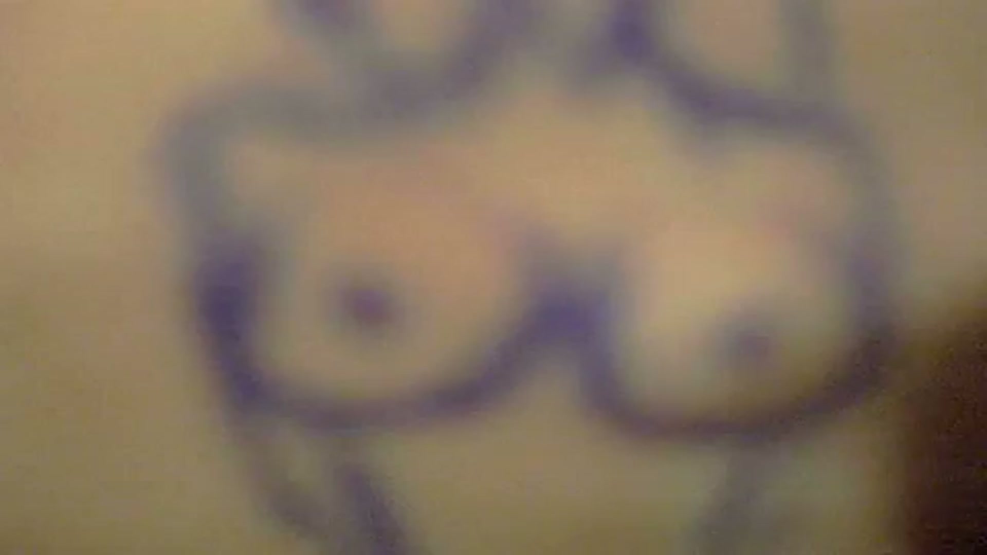 Video thumbnail for Weird Breast Implant