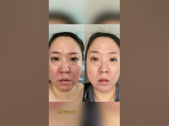 Video thumbnail for 🌟 Discover the Secret to Youthful Skin! 🌟