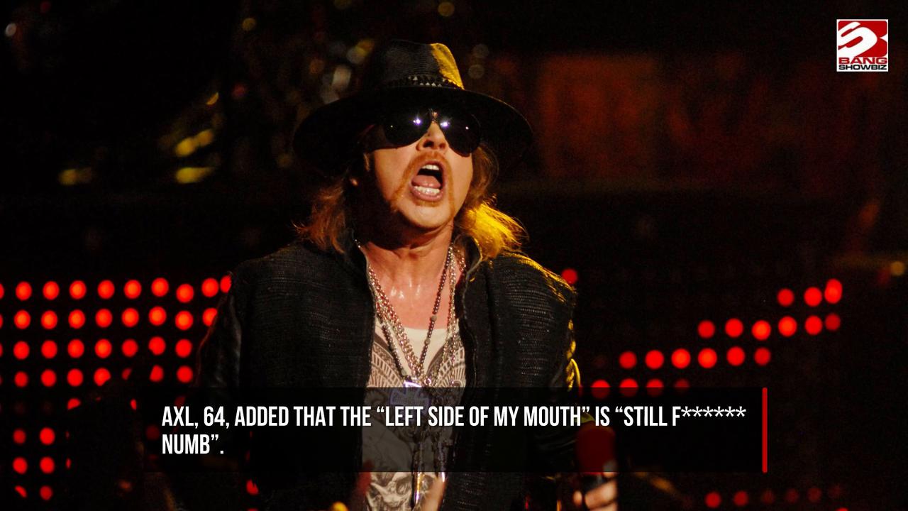 Video thumbnail for Axl Rose reveals recent jaw surgery and ongoing struggle with TMJ disorder