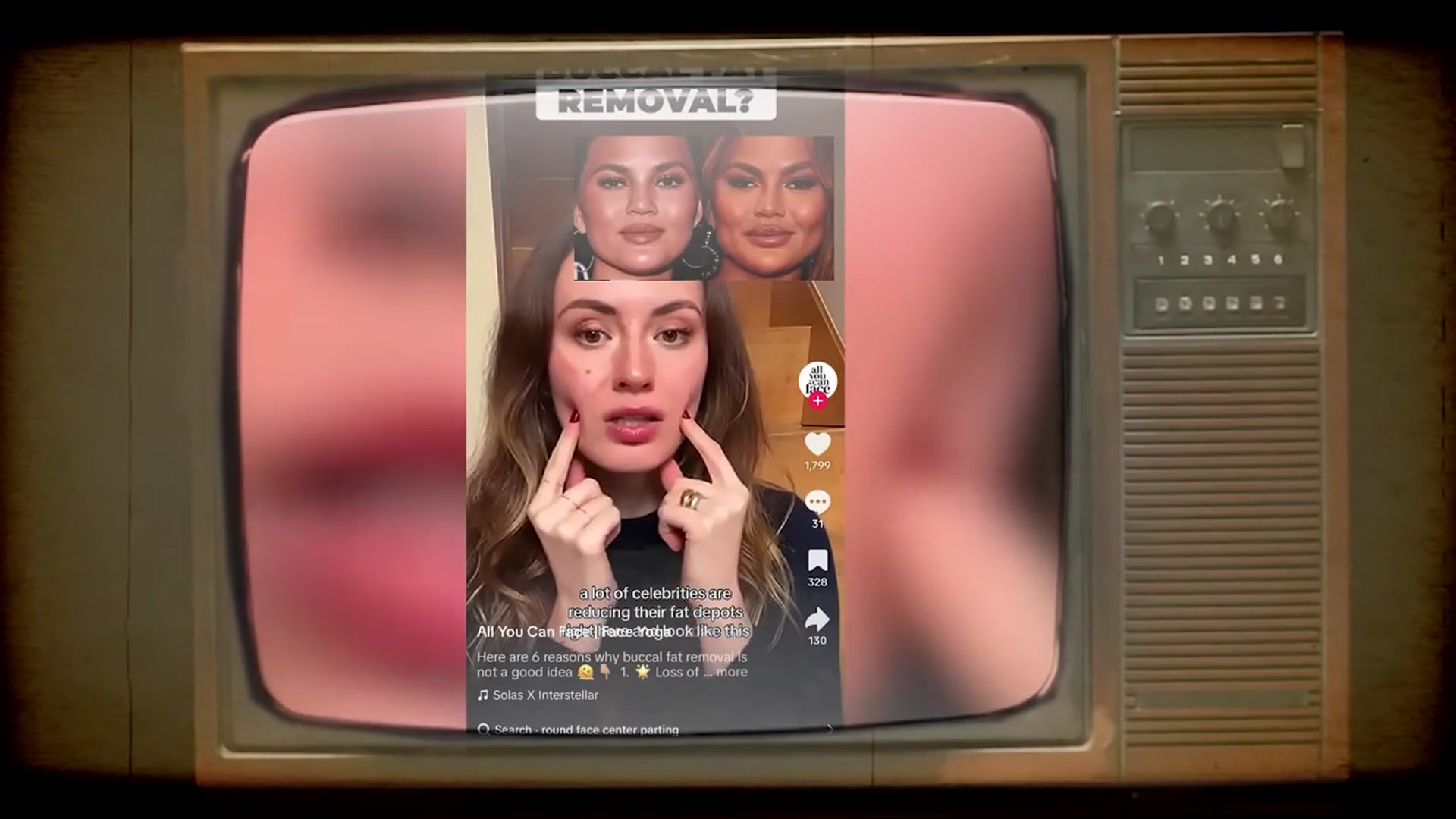 Video thumbnail for They Removed Their Buccal Fat. Now They're Paying to Get It Back