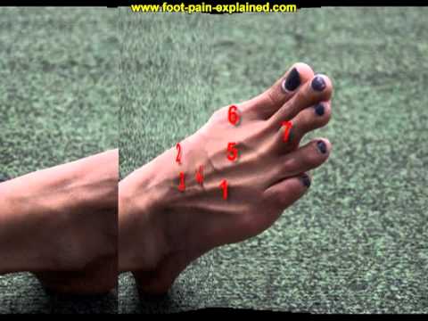 Video thumbnail for ganglion cyst