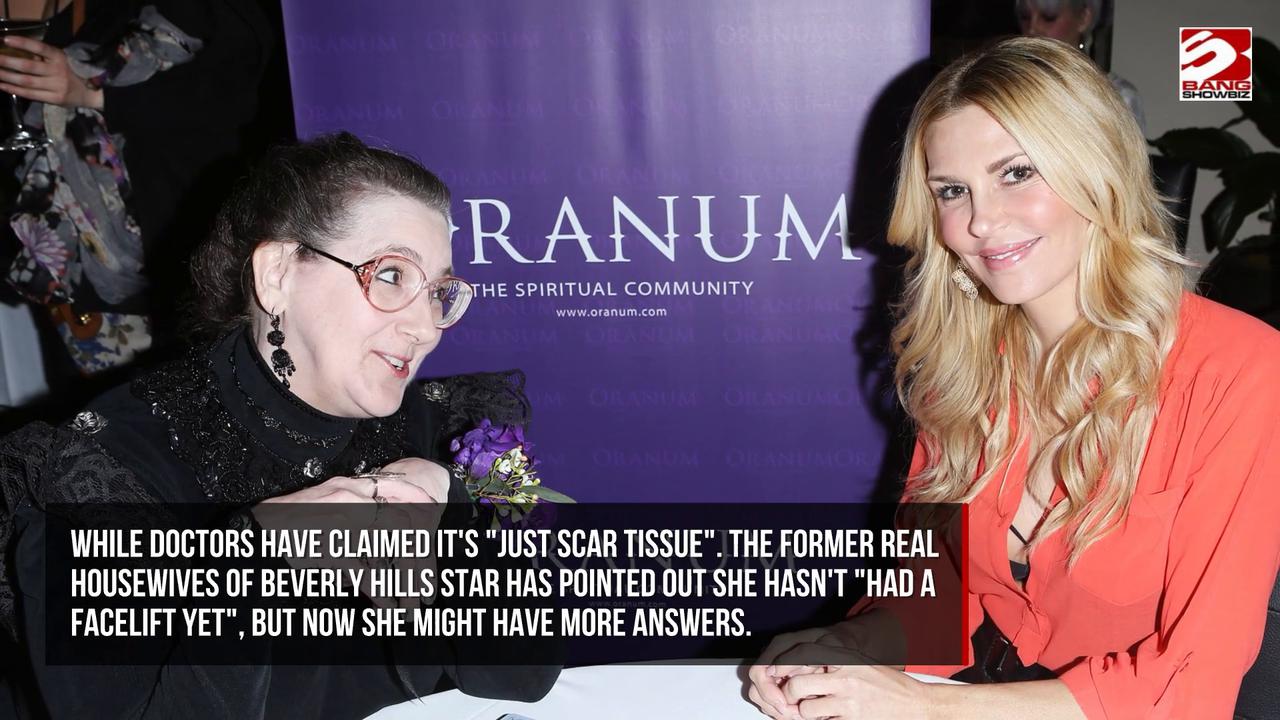 Video thumbnail for Brandi Glanville has been diagnosed with a benign tumour which may be the cause of her facial issues