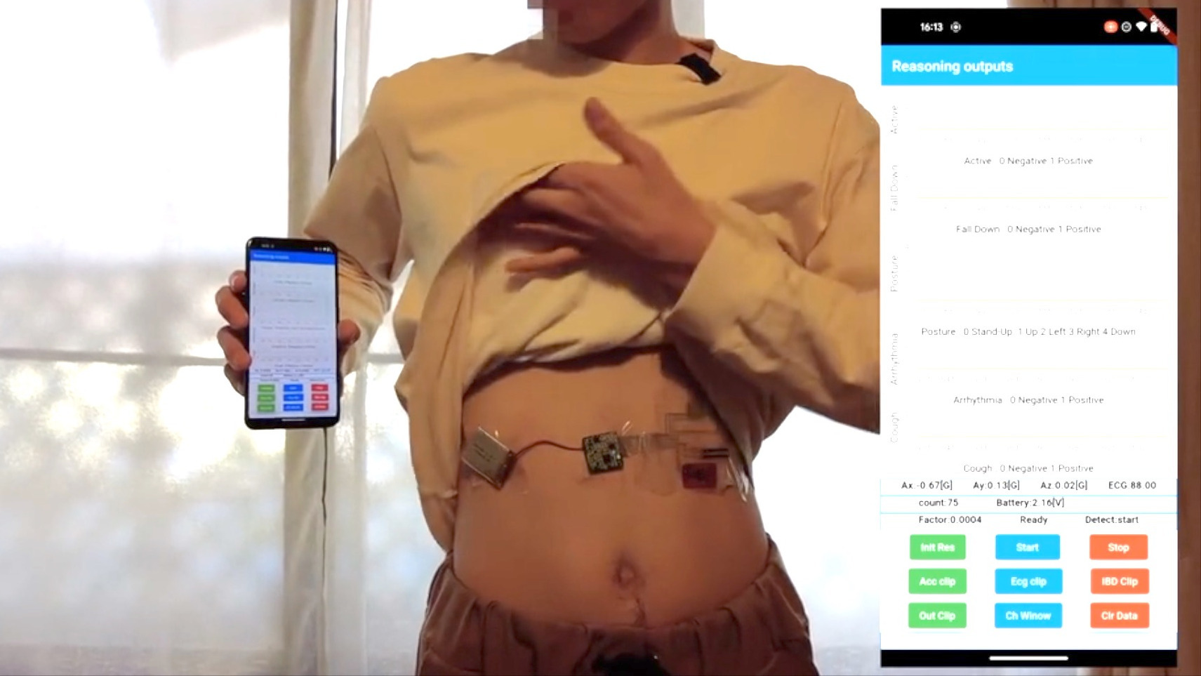 Video thumbnail for Wearable Patch May Detect Early Symptoms of a Health Episode and Warn