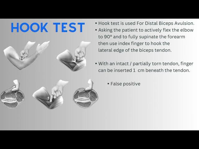 Video thumbnail for Hook test
