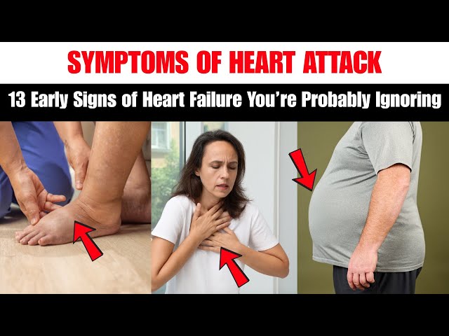 Video thumbnail for 13 Early Signs of Heart Failure You’re Probably Ignoring | 13 Big Signs of Heart Attack
