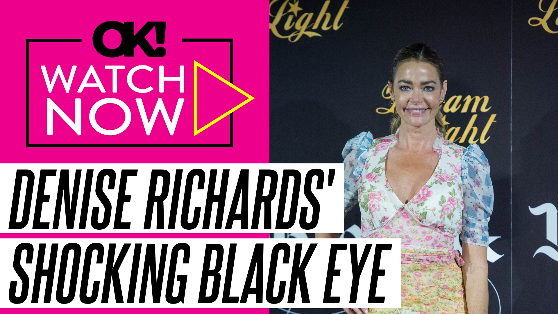 'Video thumbnail for Denise Richards Spotted With Black Eye Days After Her Unexpected Visit to Ex Aaron Phypers' Home'