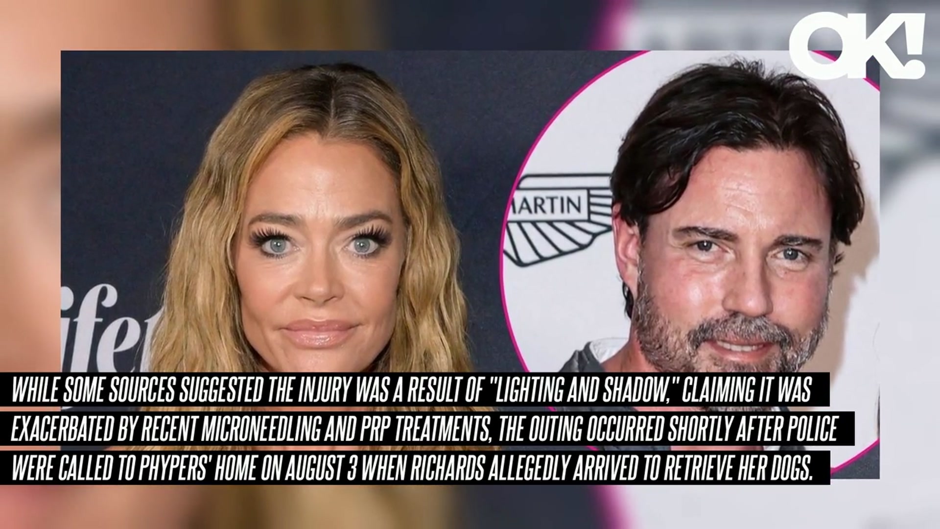 'Video thumbnail for Denise Richards Spotted With Black Eye Days After Her Unexpected Visit to Ex Aaron Phypers' Home'