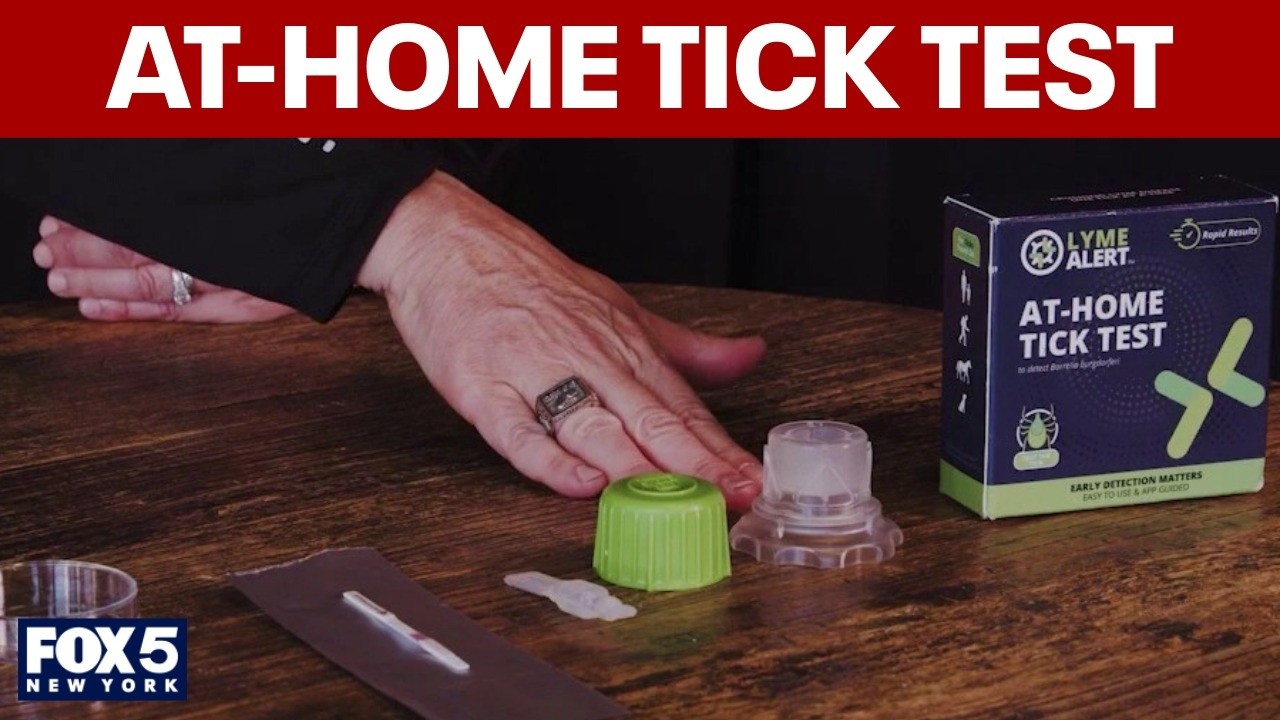 Video thumbnail for New at-home test for ticks available
