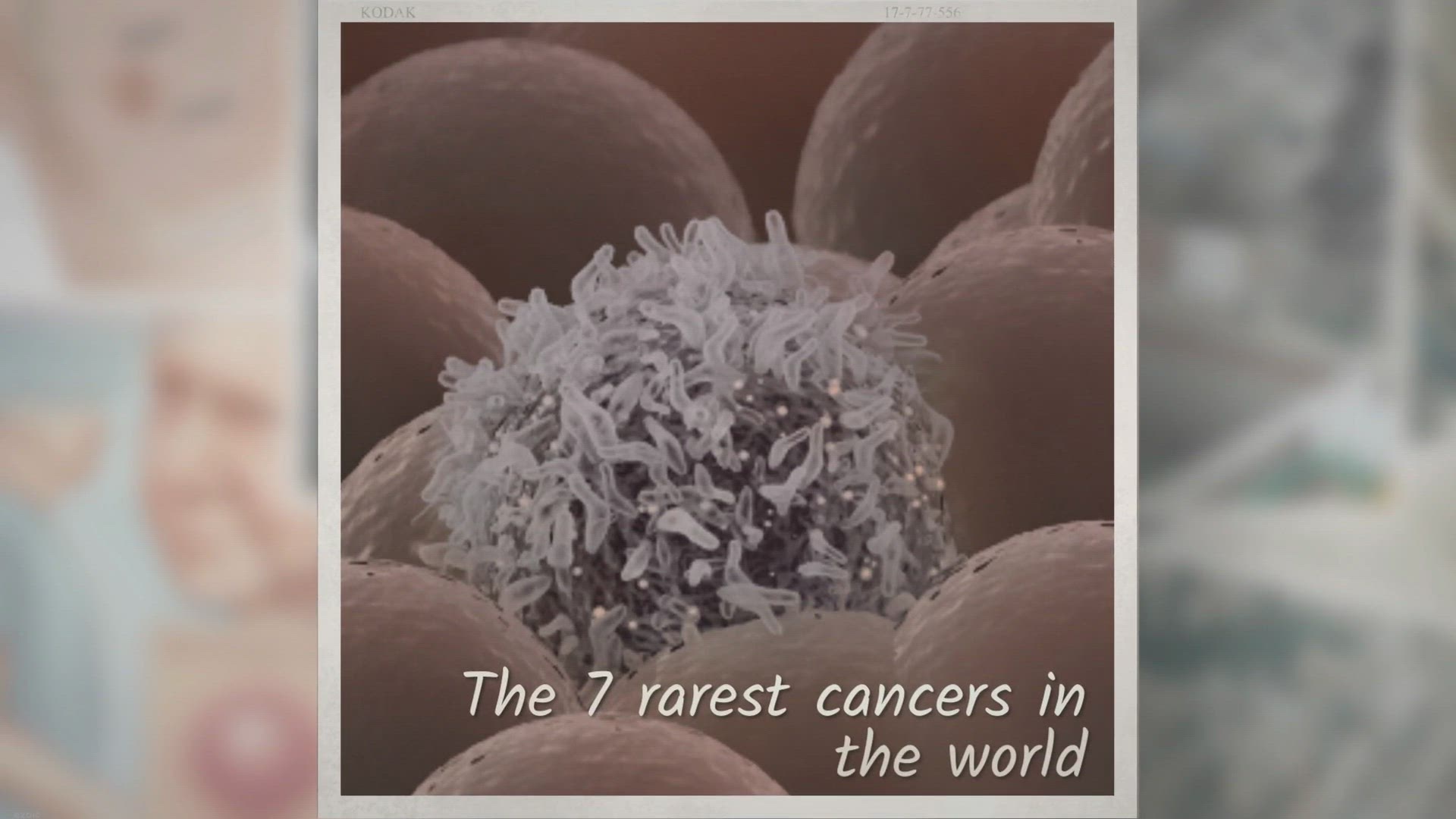 Video thumbnail for 7 Rarest Cancers in the World In 2023