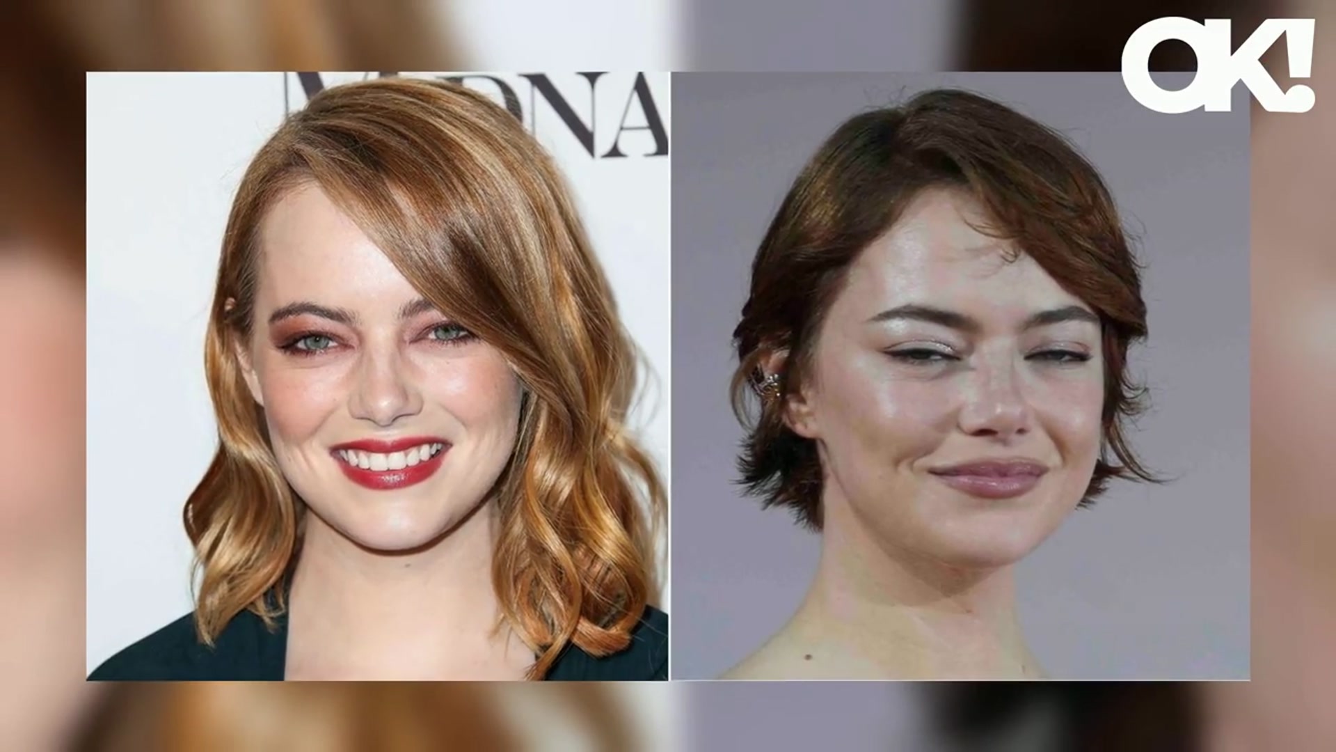 'Video thumbnail for Emma Stone's 'Scary' New Look Is a Result of an Eyelid and Face Lift, Plastic Surgeon Claims'