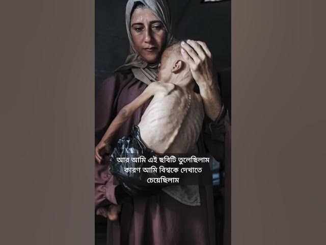 Video thumbnail for "I took this photo to show the world the extreme hunger in Gaza.😢"#bbcnews #world #share