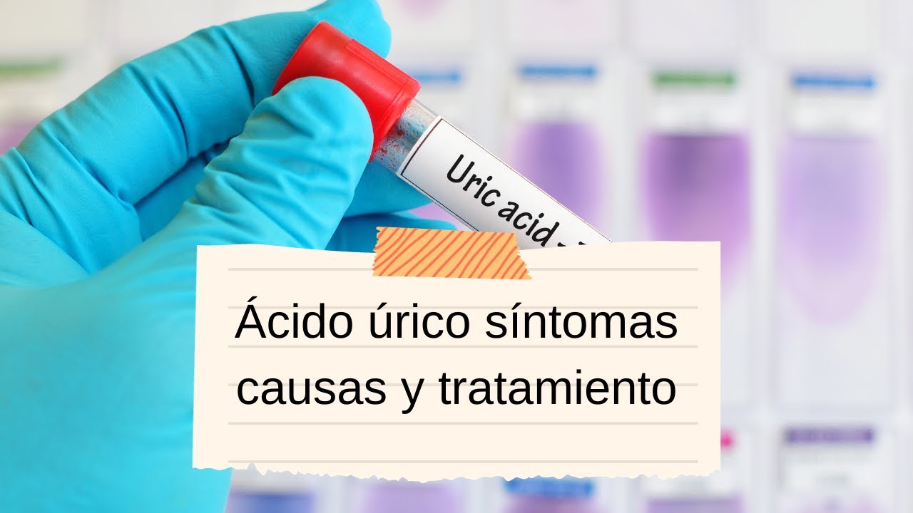 'Video thumbnail for Ácido úrico: síntomas causas y tratamiento; video blog'