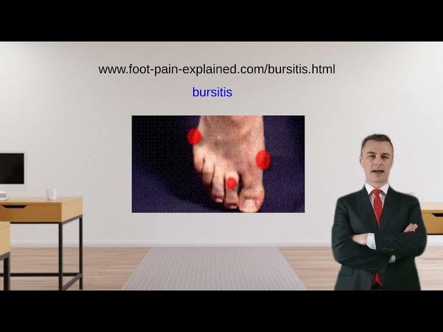 Video thumbnail for bursitis of the foot