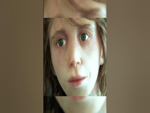 Video thumbnail for Scientists Discover Girl Born From Two Different Species