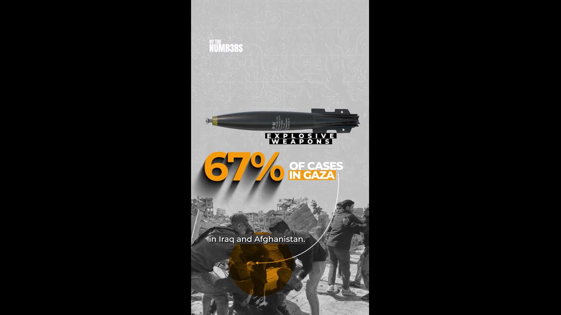 'Video thumbnail for Many civilians in Gaza sustained injuries common in soldiers'