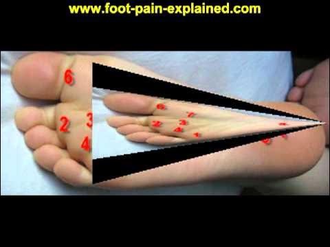 Video thumbnail for ball of foot pain