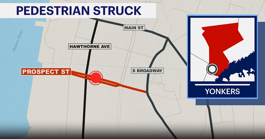 Video thumbnail for Man hospitalized after being struck by bus in Yonkers
