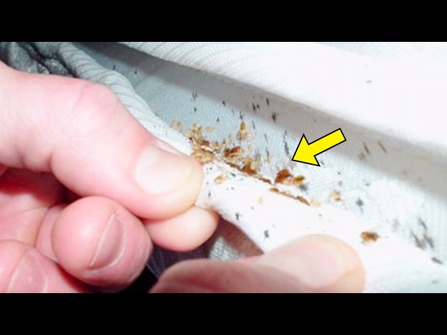 Video thumbnail for Man Thinks He Has Bed Bugs — But the Expert Freezes When He Realizes What They Actually Are